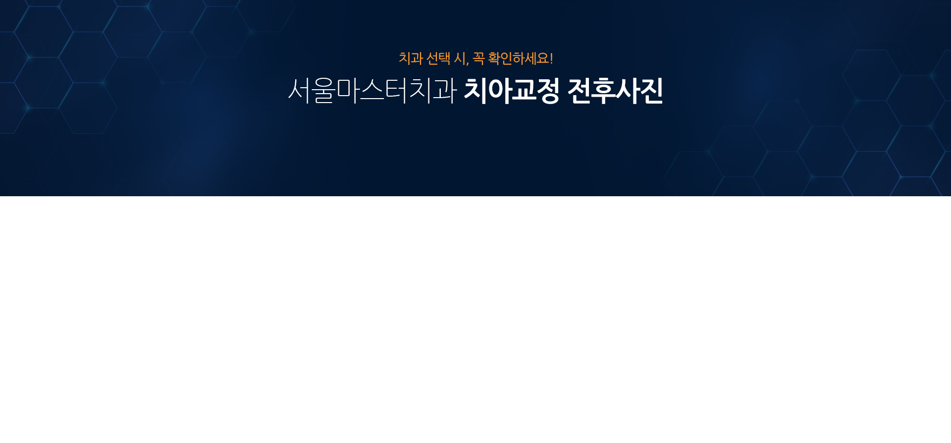 치과-선택-시-꼭-확인하세요-서울마스터치과-치아교정-전후사진