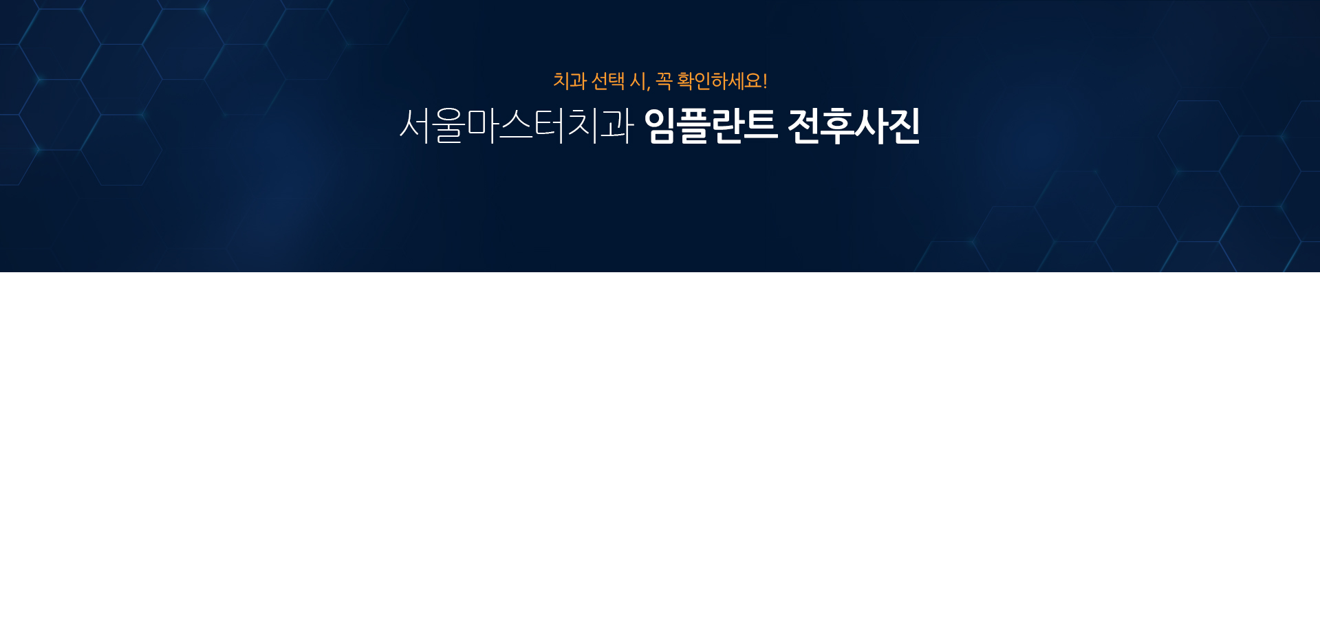 치과-선택-시-꼭-확인하세요-서울마스터치과-임플란트-전후사진