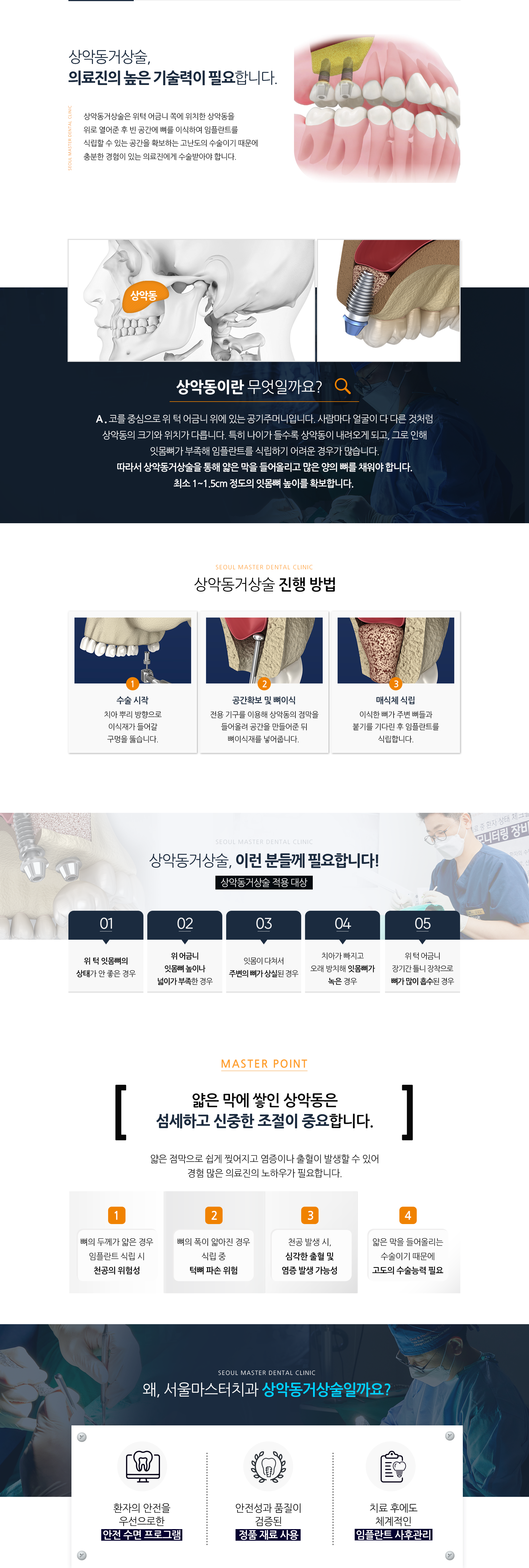 상악동거상술은-위턱-어금니-쪽에-위치한-상악동을-위로-열어준-후-빈-공간에-뼈를-이식하여-임플란트를-식립할-수-있는-공간을-확보하는-고난도의-수술이기-때문에-충분한-경험이-있는-의료진에게-수술받아야-합니다-상악동거상술-진행-방법-1단계-수술-시작-치아-뿌리-방향으로-이식재가-들어갈-구멍을-뚫습니다-2단계-공간-확보-및-뼈이식-전용-기구를-이용해-상악동의-점막을-들어-올려-공간을-만들어준-뒤-뼈이식재를-넣어줍니다-3단계-매식체-식립-이식한-뼈가-주변-뼈들과-붙기를-기다린-후-임플란트를-식립합니다-적용-대상-위-턱-잇몸뼈의-상태가-안-좋은-경우-위-어금니-잇몸뼈-높이나-넓이가-부족한-경우-잇몸이-다쳐서-주변의-뼈가-상실된-경우-치아가-빠지고-오래-방치해-잇몸뼈가-녹은-경우-위-턱-어금니-장기간-틀니-장착으로-뼈가-많이-흡수된-경우