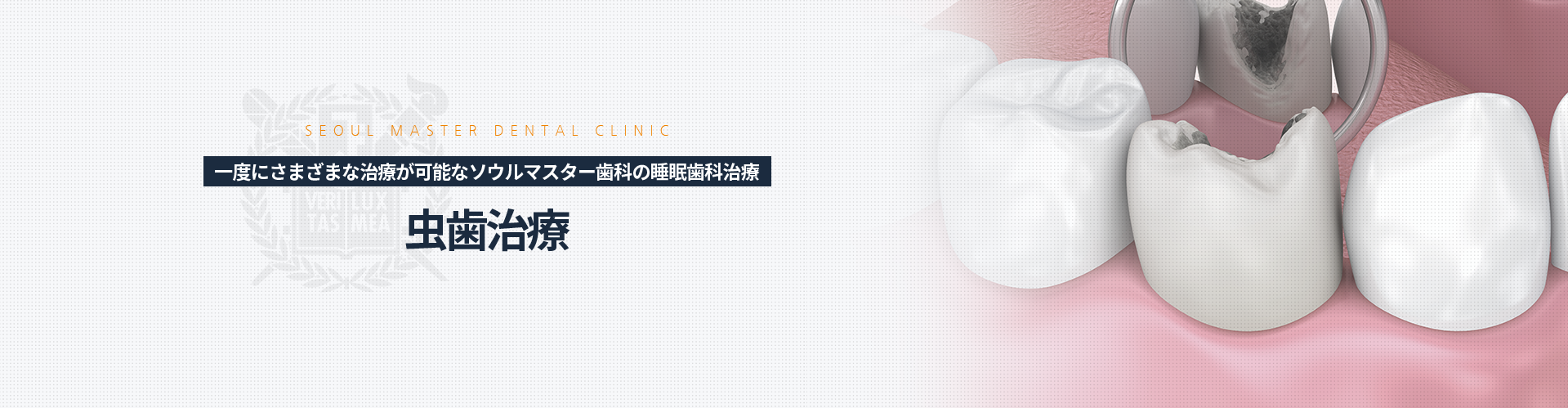 한-번에-다양한-치료가-가능한-서울마스터치과-수면치과치료-충치치료