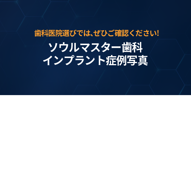 치과-선택-시-꼭-확인하세요-서울마스터치과-임플란트-전후사진