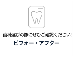 전후사진